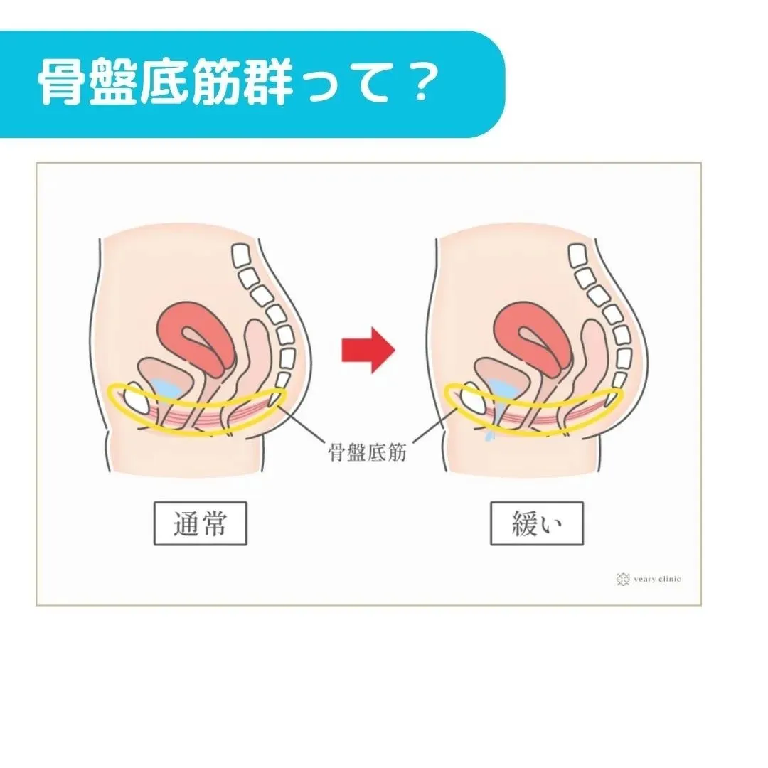 最近話題の膣トレ